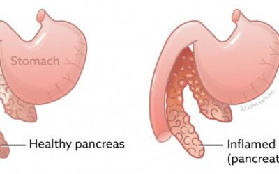 Pancreatitis and Pork